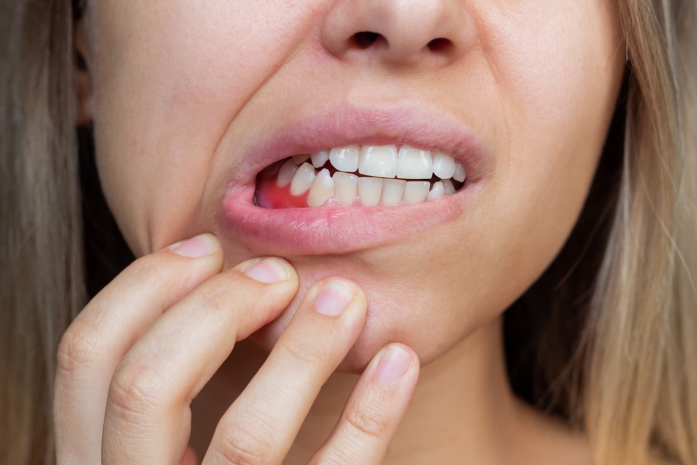 Gum disease treatment clinton Dr. David Henry Dr. Stephen Greer. Northside Dental Group General, Cosmetic, Restorative, Pediatric Dentistry dentist in Clinton MS 39056